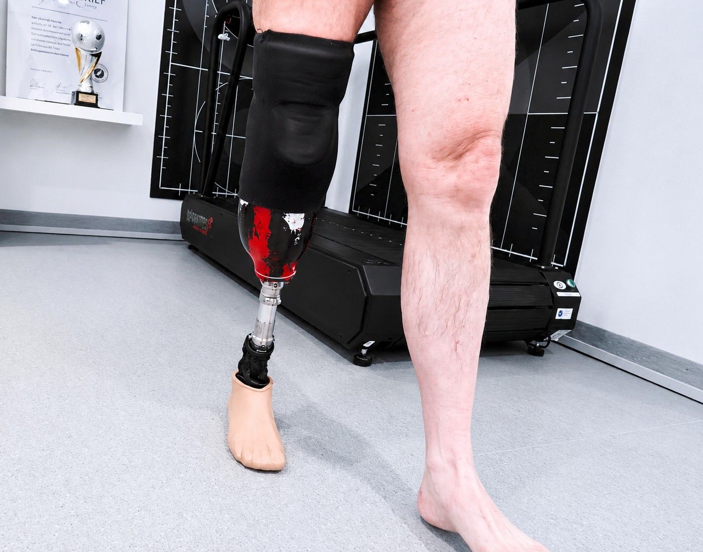 Patient mit Beinprothese in der Gangschule bei Kächele